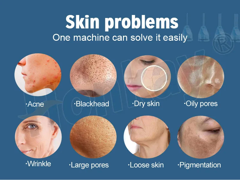 8 in 1 Oxygen Jet Peel Machine for Intense Hydration Wrinkle Removal and Restore the Elasticity of Skin